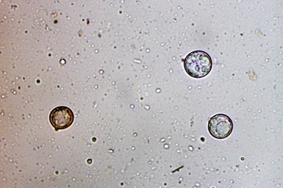amanita-battarrae10