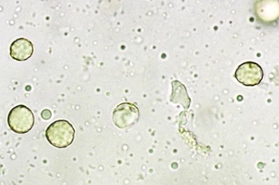 amanita-battarrae6