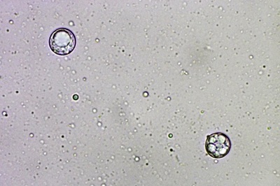 amanita-battarrae9