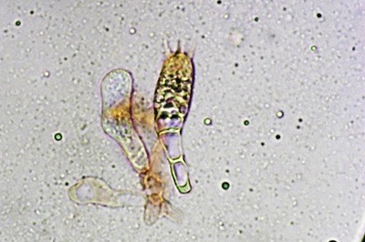 amanita-gemmata10