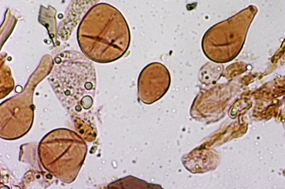 amanita-gemmata12