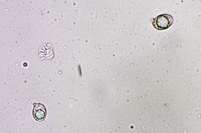 amanita-gemmata8