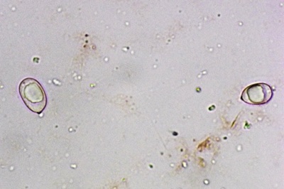 amanita-strobiliformis10