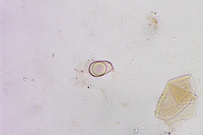 amanita-strobiliformis9