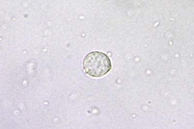 amanita-vaginata5