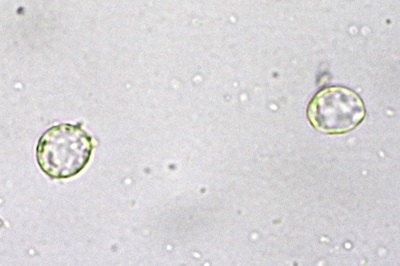 amanita-vaginata6