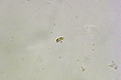 anthoporia-albobrunnea10