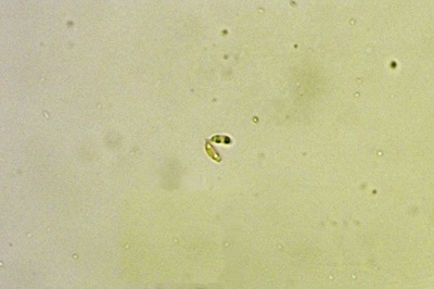 anthoporia-albobrunnea9