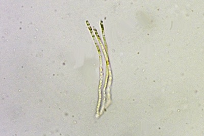 arachnopeziza-trabinelloides11