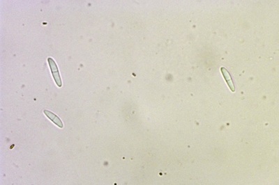 arachnopeziza-trabinelloides8