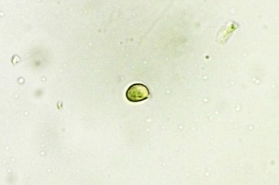 armillaria-ostoyae1