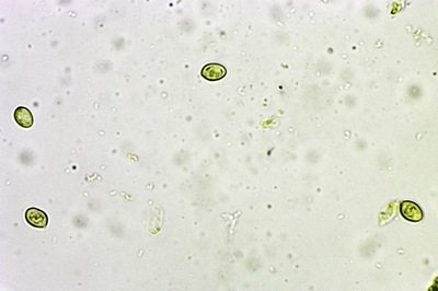 armillaria-ostoyae2