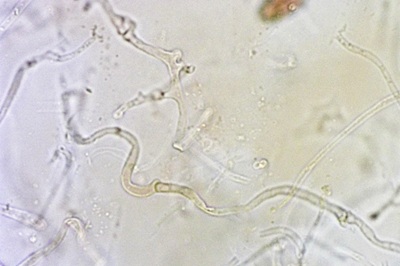 auricularia-auricula-judae11