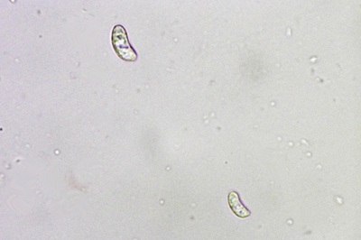 auricularia-cerrina11