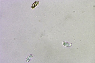 auricularia-cerrina9