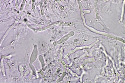 auriporia-aurulenta11