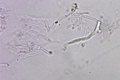 auriporia-aurulenta12