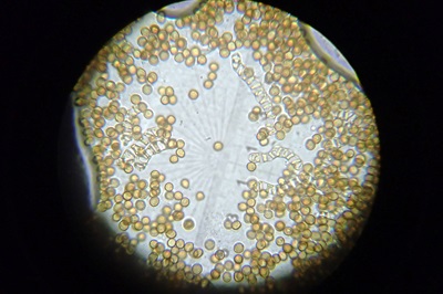 battarrea-phalloides6