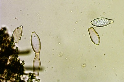 botryobasidium-aureum10