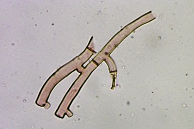 botryobasidium-aureum12