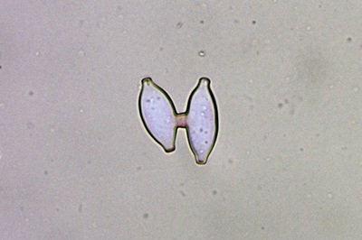 botryobasidium-aureum9