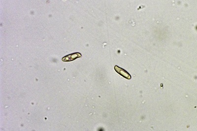 butyriboletus-regius11