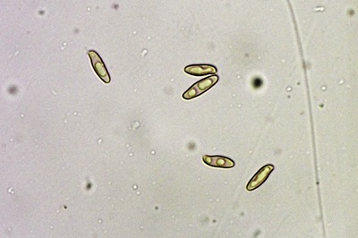 butyriboletus-regius12