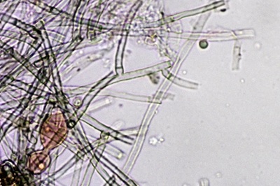 byssocorticium-atrovirens12