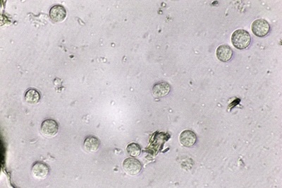 ceratiomyxa-fruticulosa2