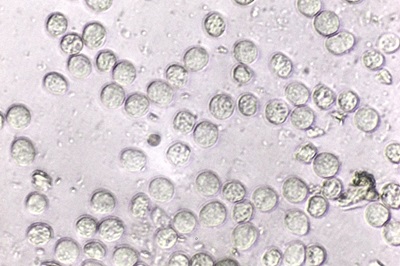 ceratiomyxa-fruticulosa3