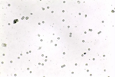 ceratiomyxa-fruticulosa4