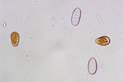 ceratiomyxa-fruticulosa9