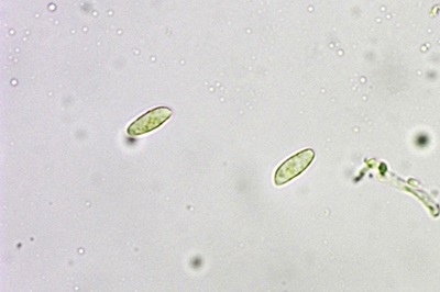 cerioporus-squamosus6