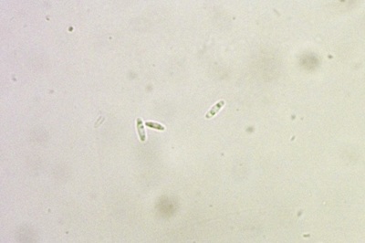 chlorociboria-aeruginascens4