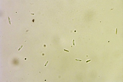 chlorociboria-aeruginascens5