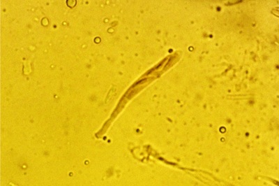 chlorociboria-aeruginascens6