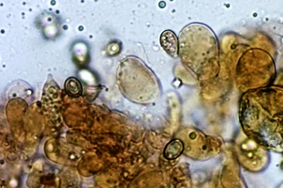 chlorophyllum-olivieri12