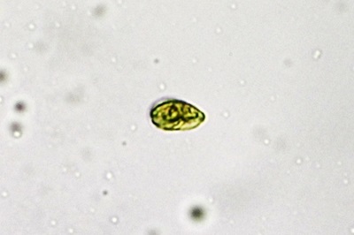 clavariadelphus-pistillaris9