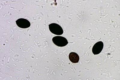 coprinopsis-picacea6