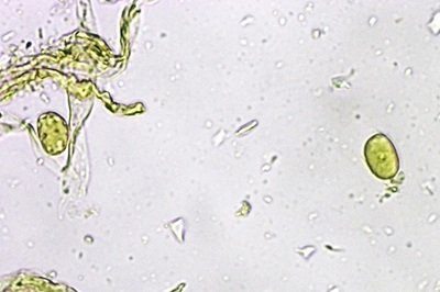 craterellus-cornucopioides2