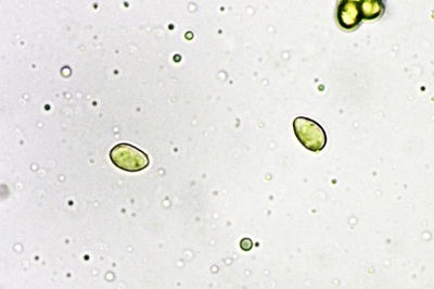 craterellus-lutescens11