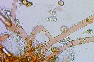 craterellus-tubaeformis12