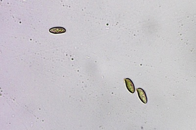 cyanoboletus-pulverulentus11