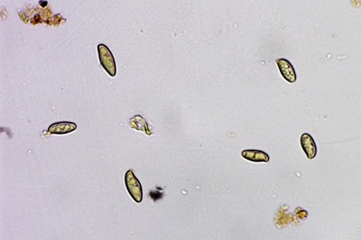 cyanoboletus-pulverulentus12