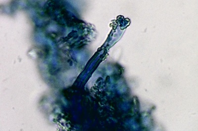 dacryobolus-karstenii11