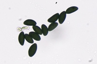 daldinia-concentrica3