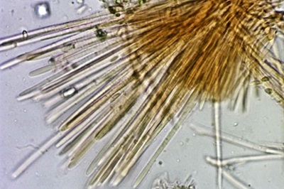 dasyscyphella-nivea11