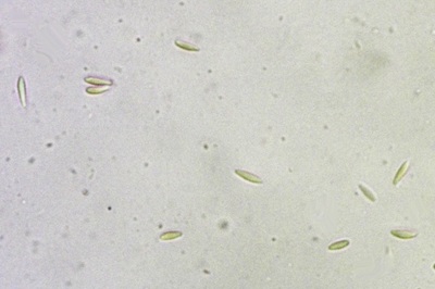 dasyscyphella-nivea8