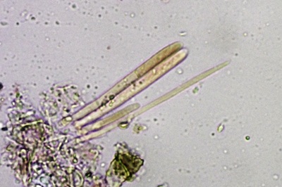 dasyscyphella-nivea9