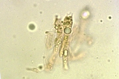 desarmillaria-tabescens9